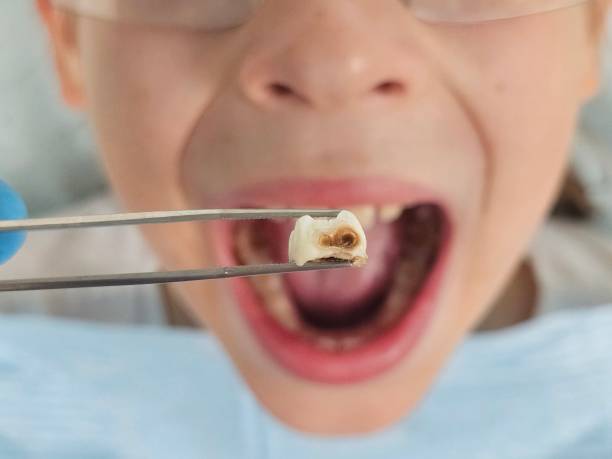 Best Emergency Dentist for Kids  in Pearl River, LA